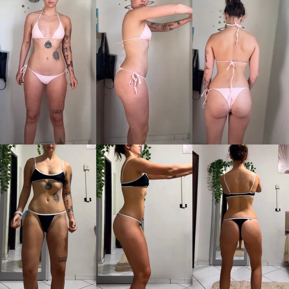 Antes e depois de uma paciente da Rafaela ou aluna da Francielli