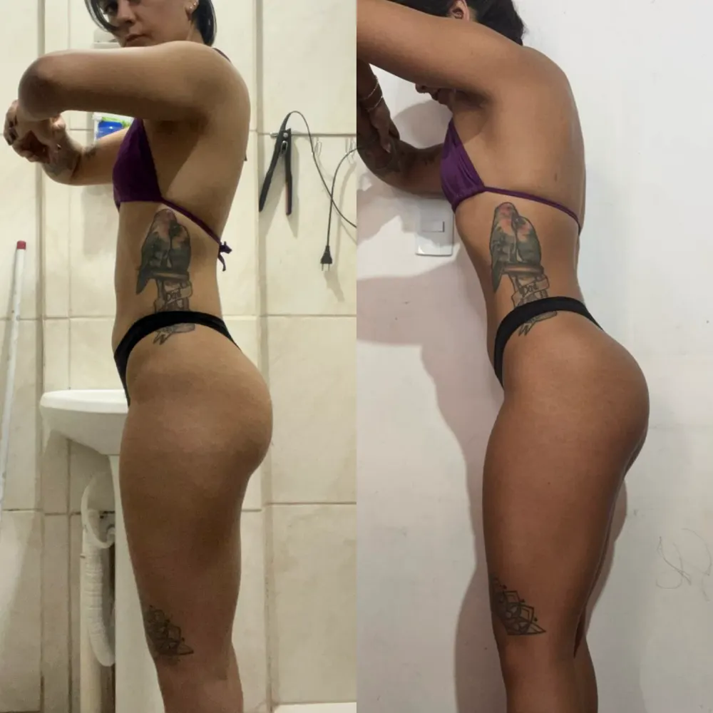 Antes e depois de uma paciente da Rafaela ou aluna da Francielli